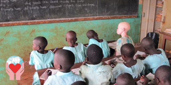 bambino albino in Congo